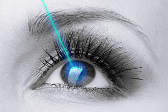 Laser Cataract Surgery